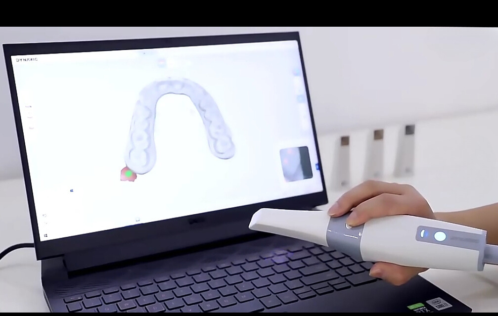 3D Intraoral Dental Scanner with Real-Time Display & Free Software