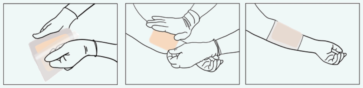 Foam Dressing