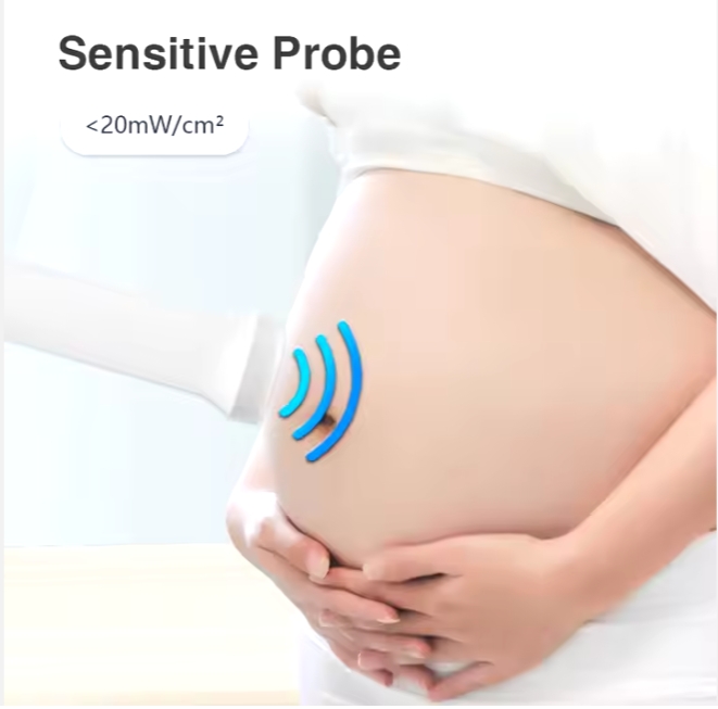 Portable Fetal Doppler Monitor - Hear Your Baby's Heartbeat Anytime, Anywhere