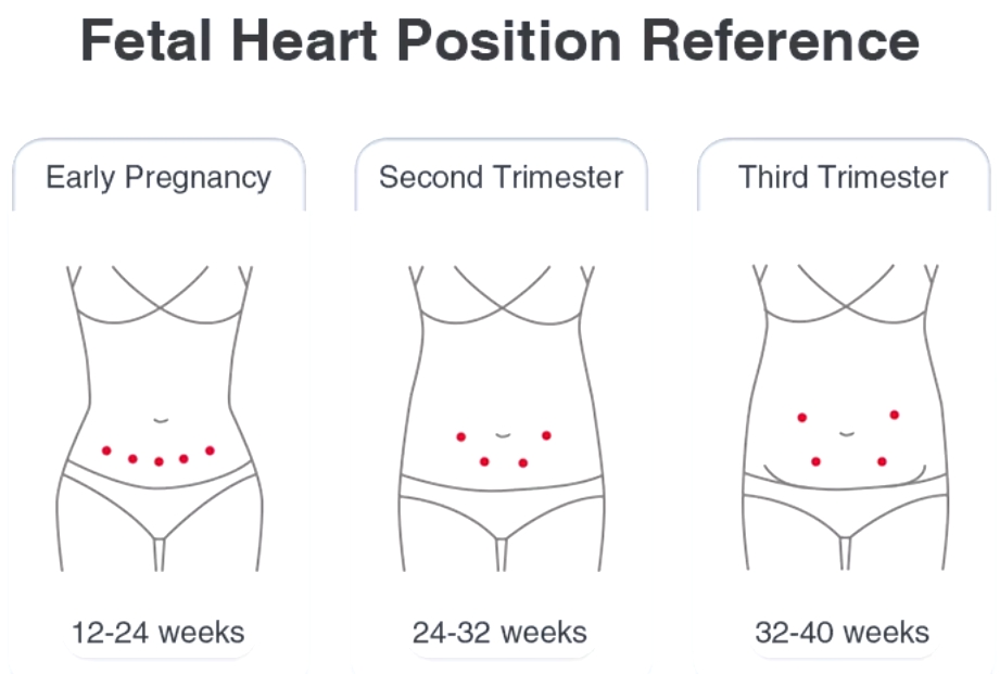 Portable Fetal Doppler Monitor - Hear Your Baby's Heartbeat Anytime, Anywhere