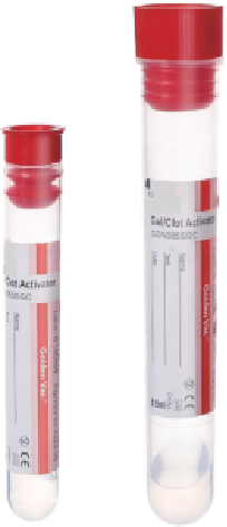 Golden Vac™ Serum Separator Tubes – Reliable Serum Collection for Chemistry, Immunology, and Serology