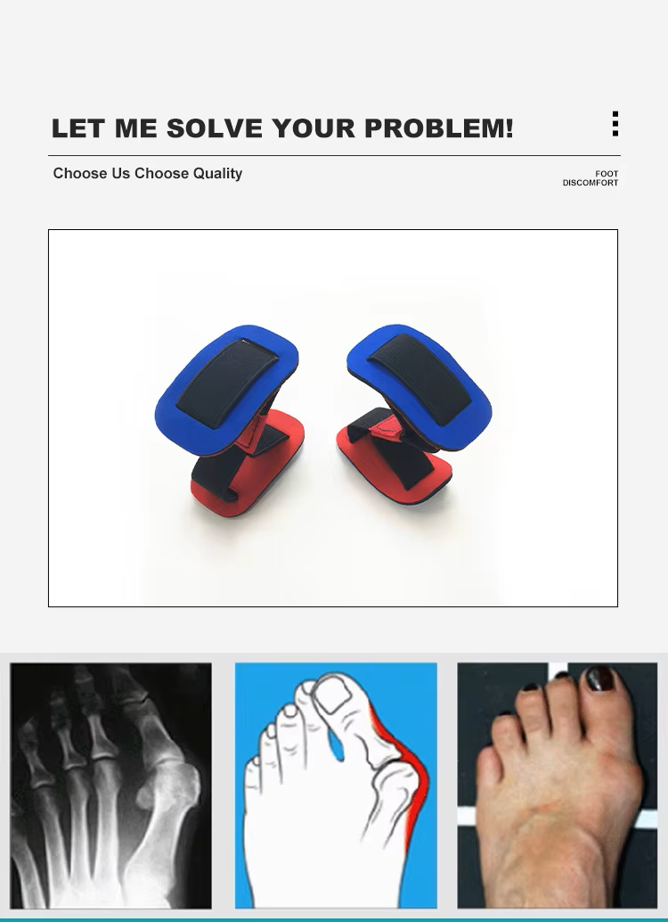 99insoles Hallux Valgus Training Belt Strap | Bunion Corrector & Toe Stretcher