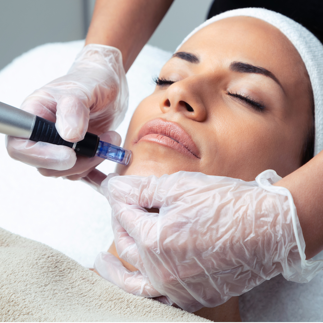NANONEEDLING + PEELING DOUX