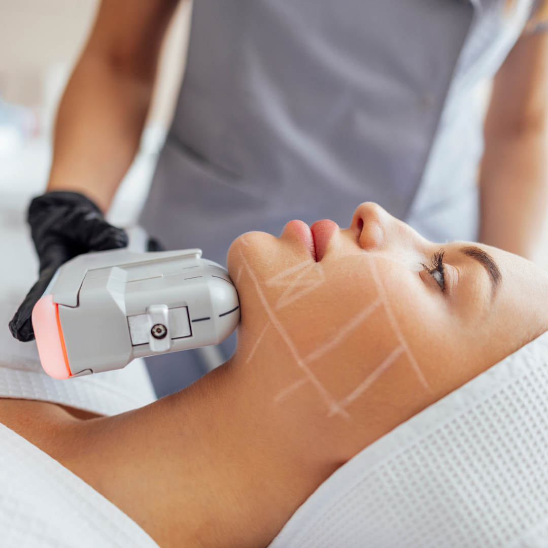HIFU Visage Lifting sans chirurgie