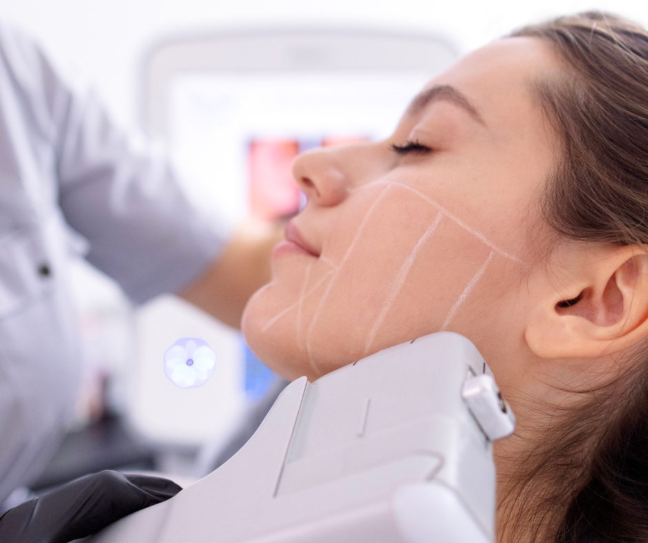 HIFU Ovale du Visage 