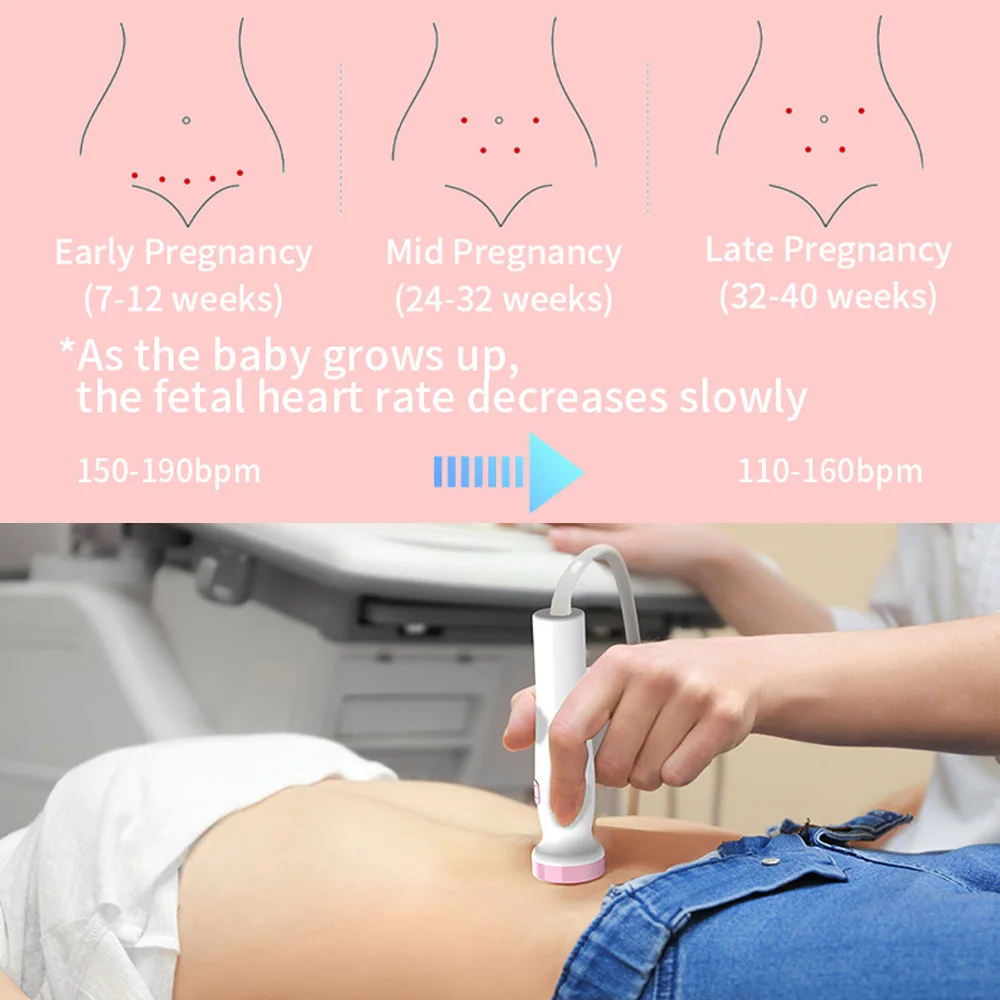 Monitor Fetal. Detector ultrasónico de frecuencia cardíaca para bebé, estetoscopio, Doppler, Mujeres Pregnadas, Frecuencia 3MHz