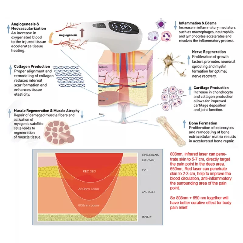 Dispositivo de terapia láser para el dolor corporal, equipo de fisioterapia LLLT de 2x808nm para alivio del dolor de rodilla, artritis, hombro congelado, tratamiento de mascotas