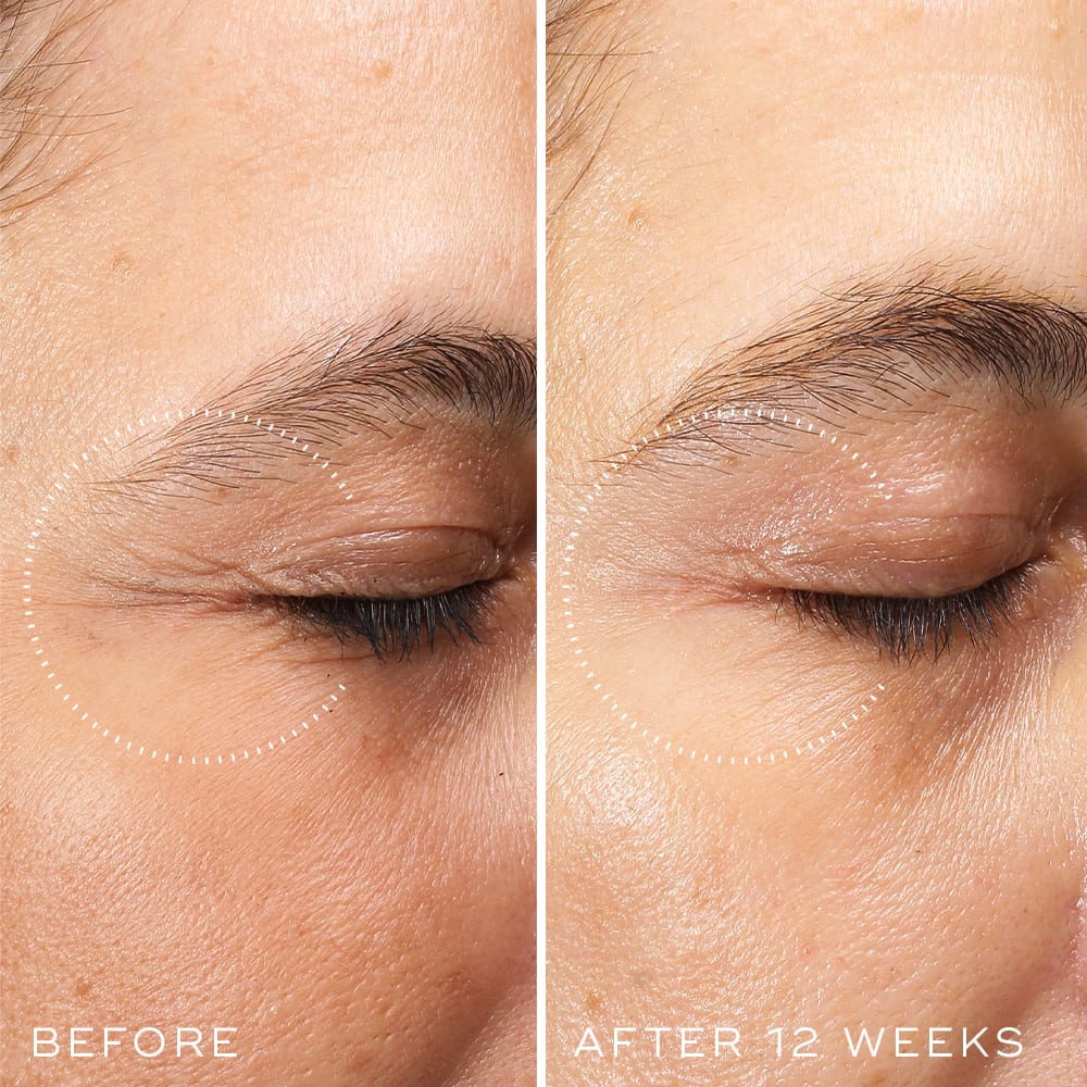 CRYSTAL RETINAL CERAMIDE EYE 3