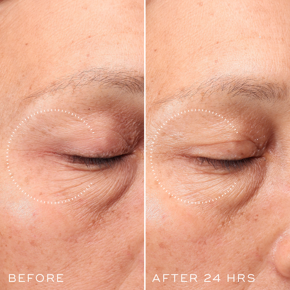 CRYSTAL RETINAL CERAMIDE EYE 3