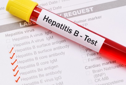 Hepatite B HBSAG