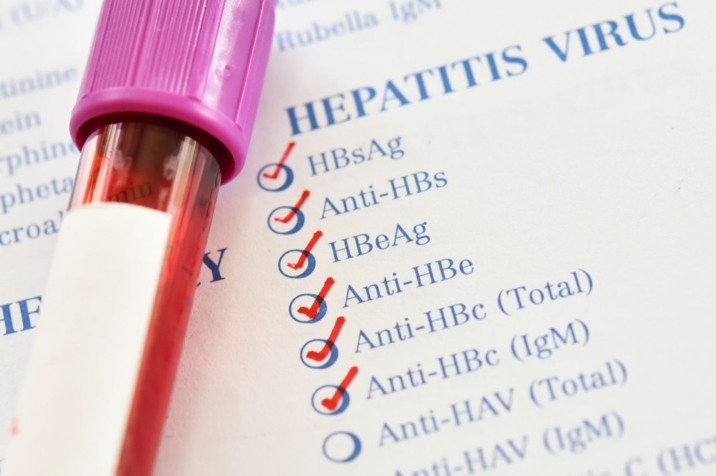 Hepatite B Anti-HBS