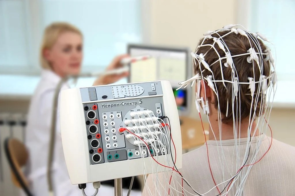 Eletroencefalograma EEG