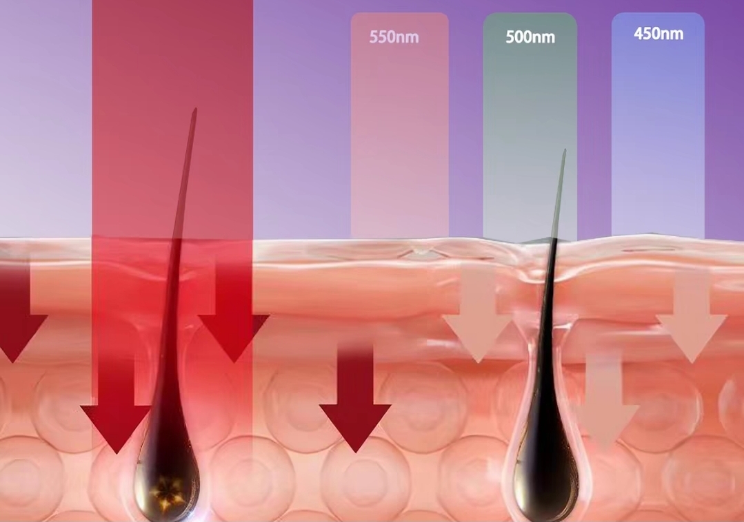 IPL Hair Removal Device