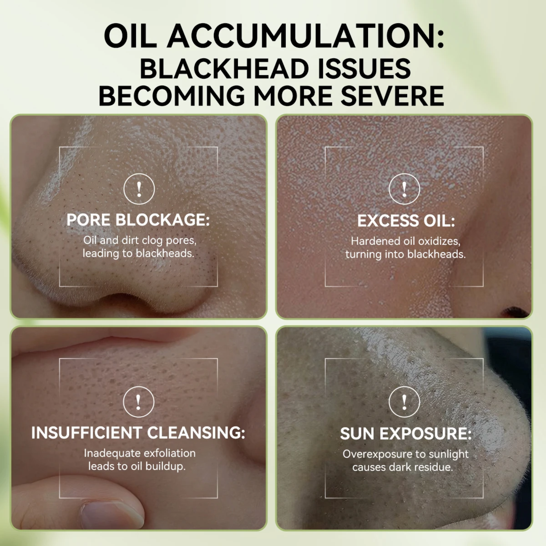 LANBENA Bamboo Charcoal Blackhead Mask Kit