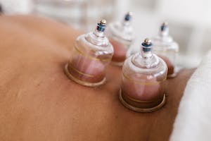 Cupping Therapy 60 min
