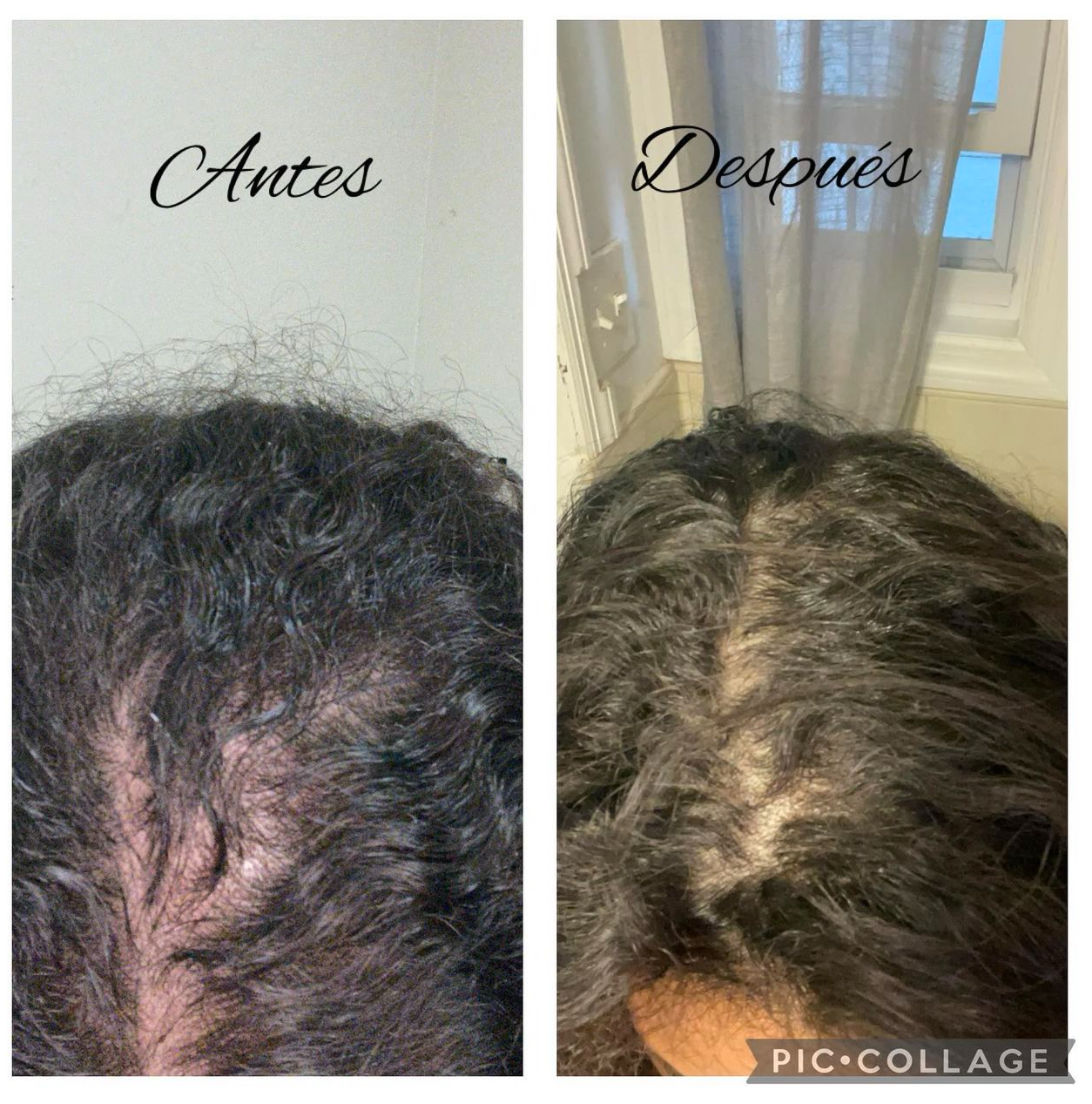 HAIR DROPPER/GOTERO