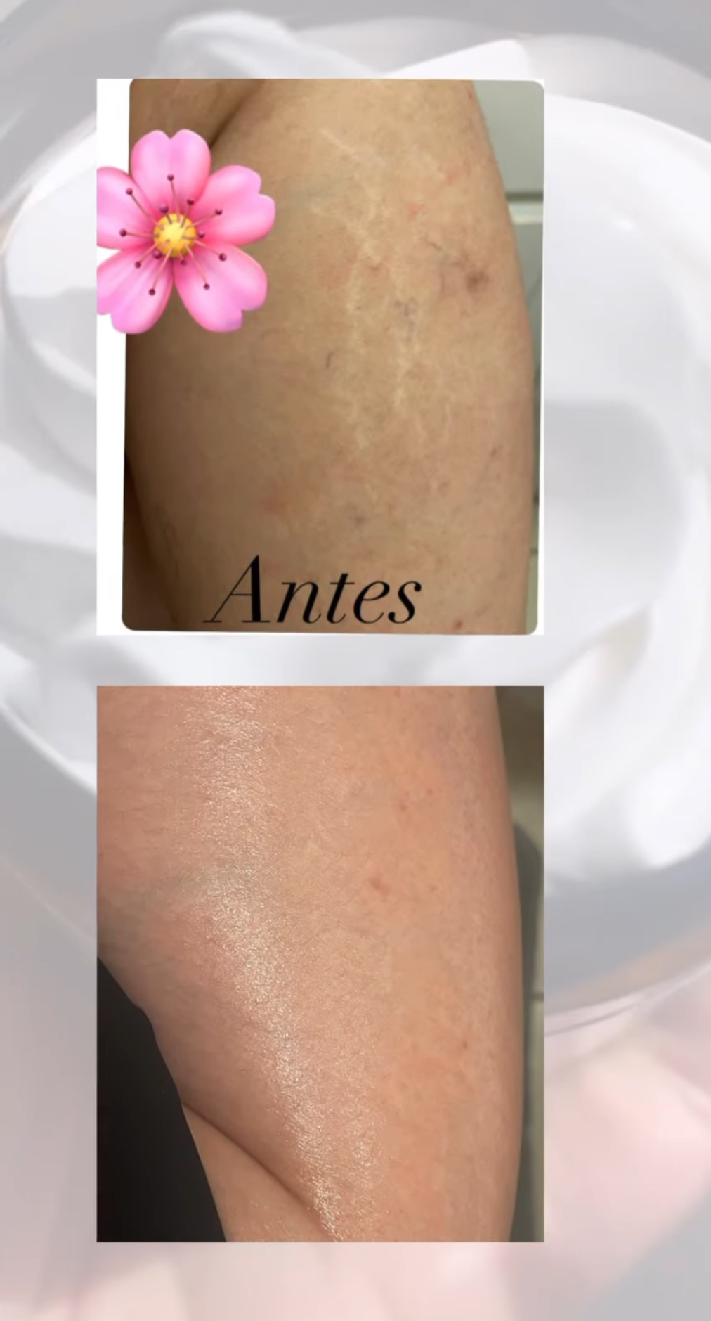 ACEITE ORGANICO REGENERADOR Y ANTI-ESTRIAS