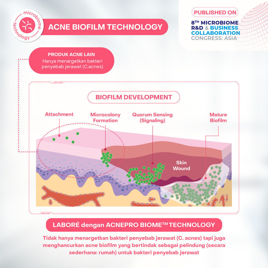 Toner Eksfoliasi Wajah Kulit Berjerawat