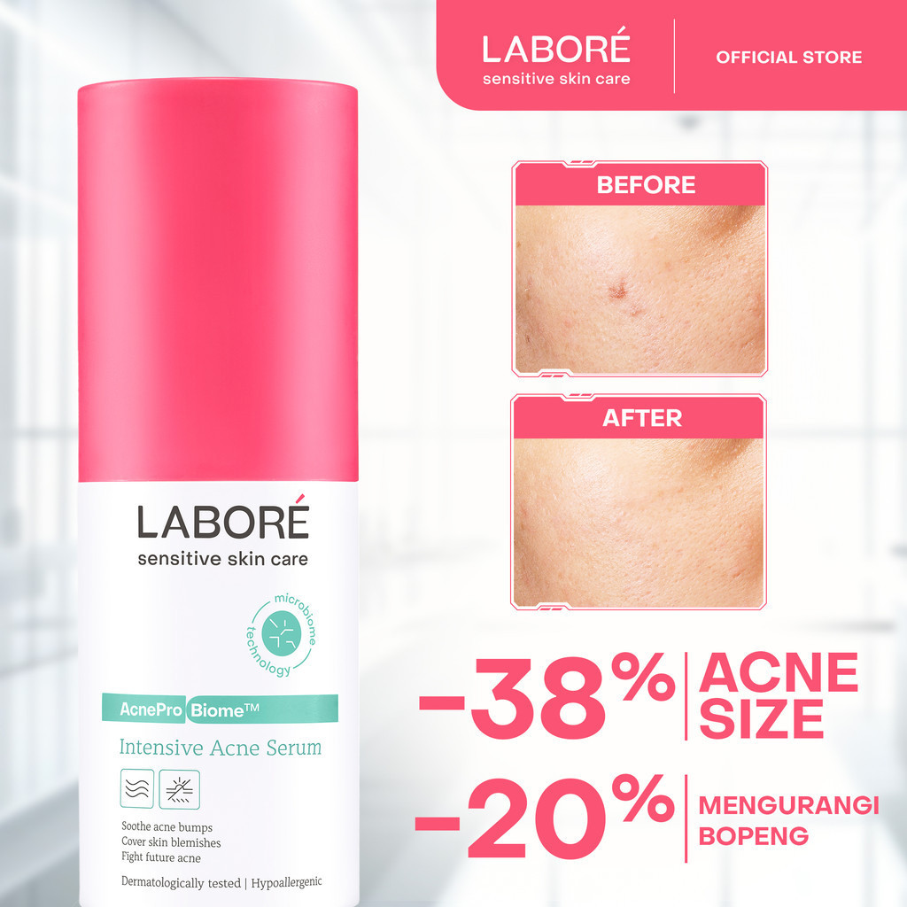 Serum Intensif Kulit Wajah Berjerawat