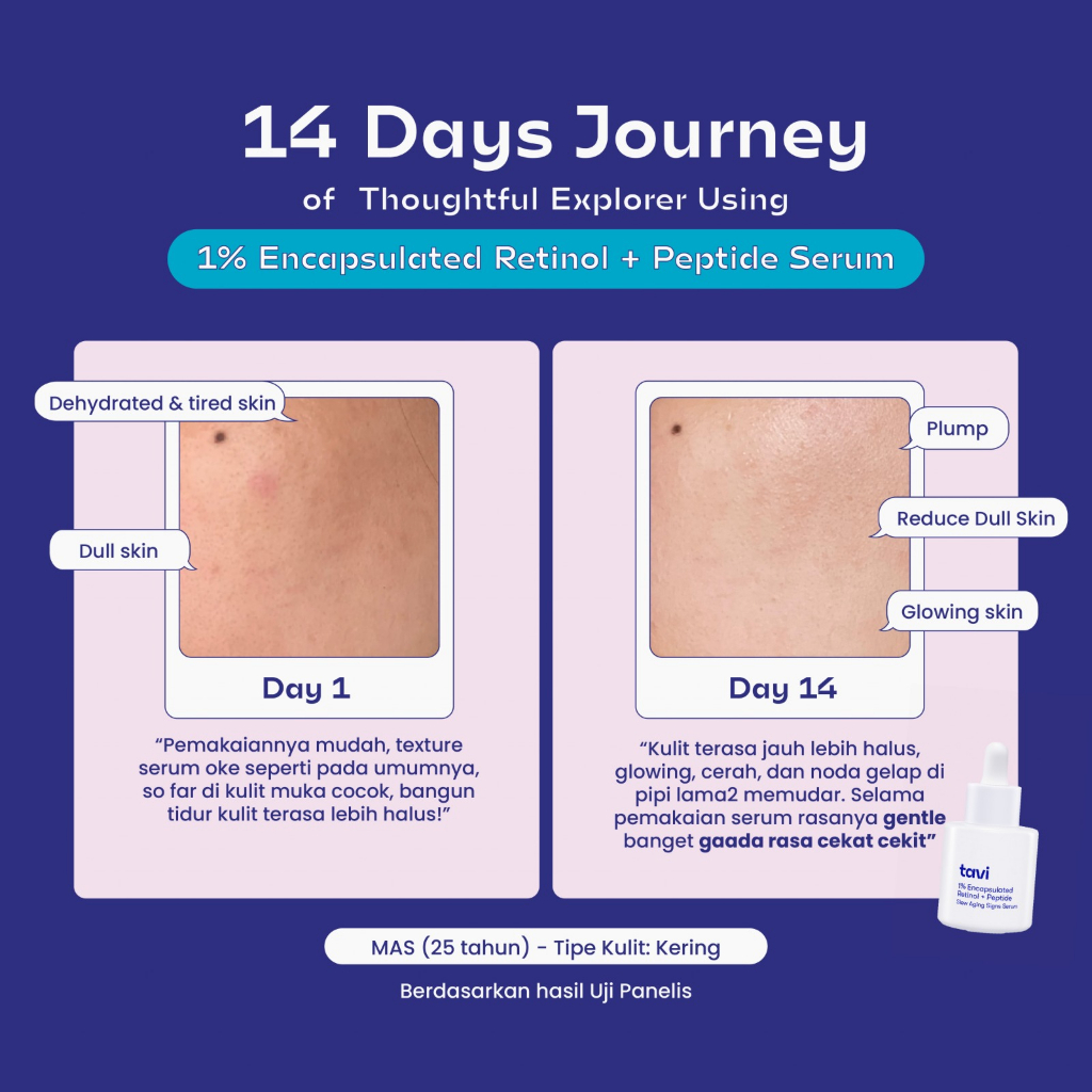 TAVI 1% Encapsulated Retinol + Peptide Slow Aging Signs Serum 30 ml - Retinol Pemula Mencegah Jerawat Dark Spot & Aging