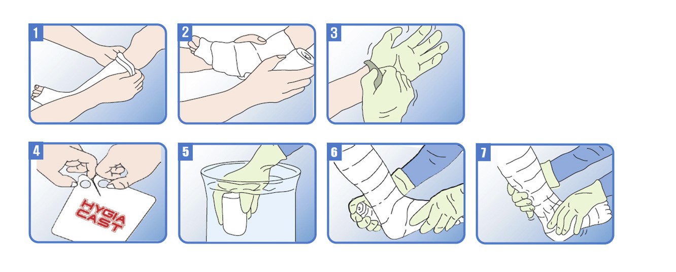 HYGIA CAST- FIBERGLASS- 4 inch WHITE COLOUR