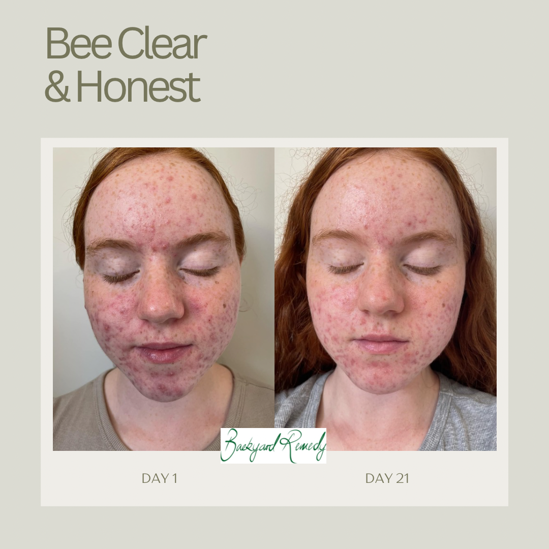 Bee Clear & Honest