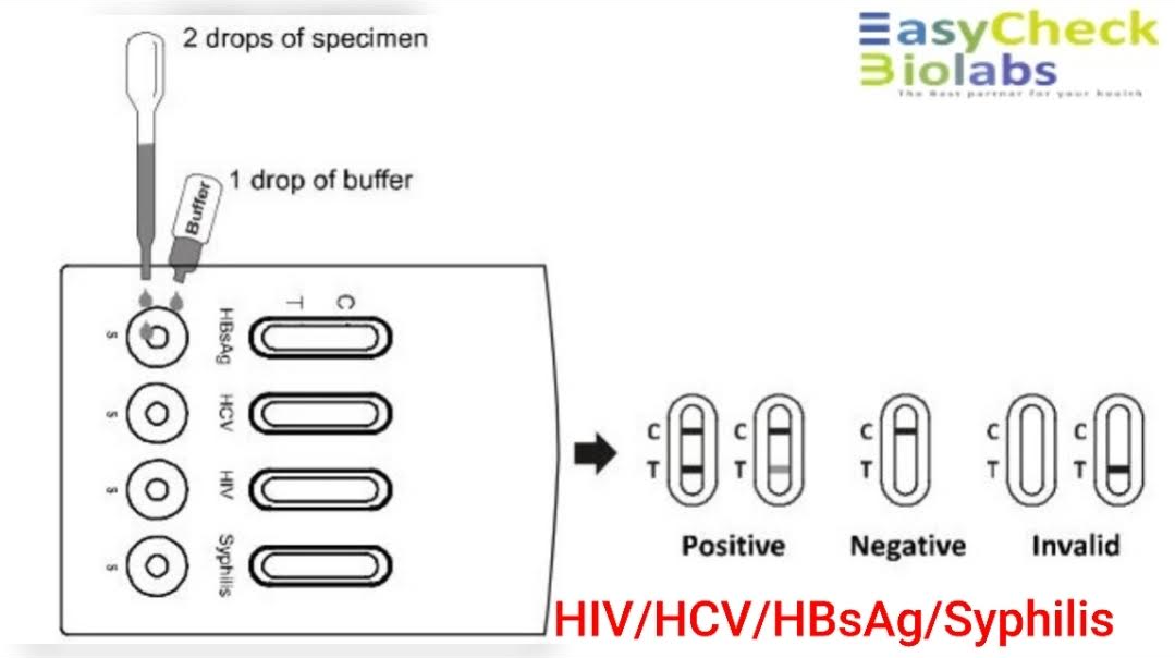 HIV / Syphilis / HCV / HBsAg multicassette S, P, WB (20 tests)