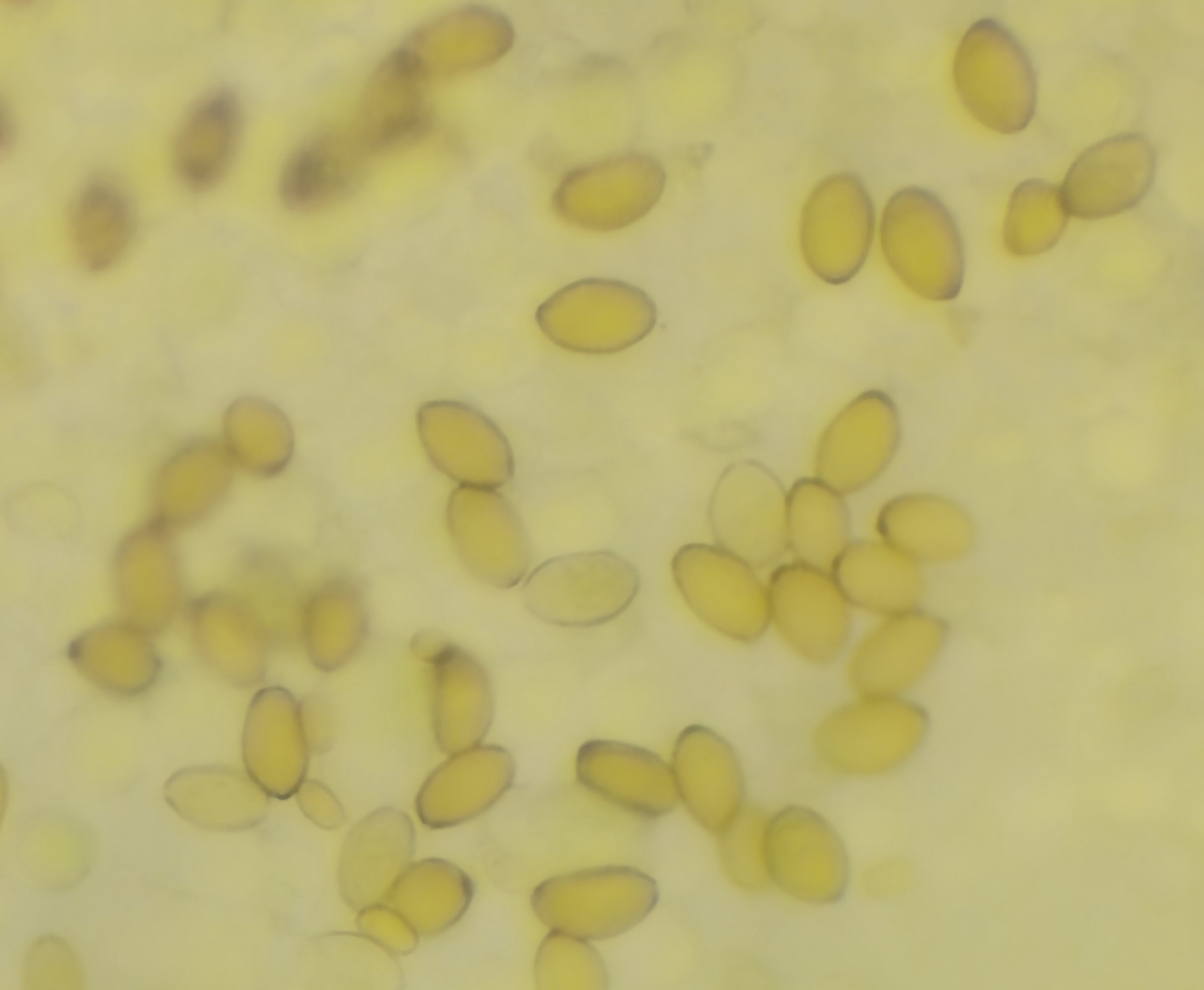Supa Chupa "Golden Child" Spore Print