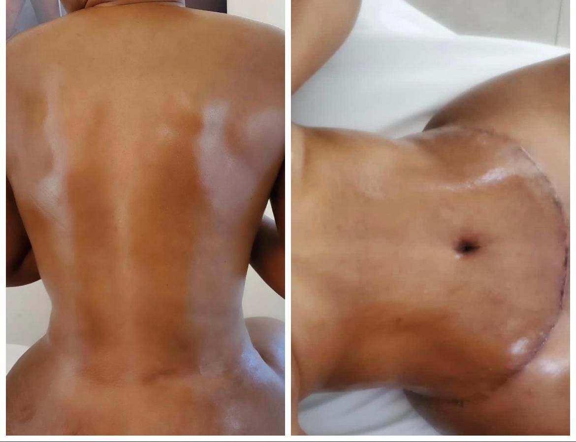 Manual Lymphatic Draining - (50 minutes session (5)