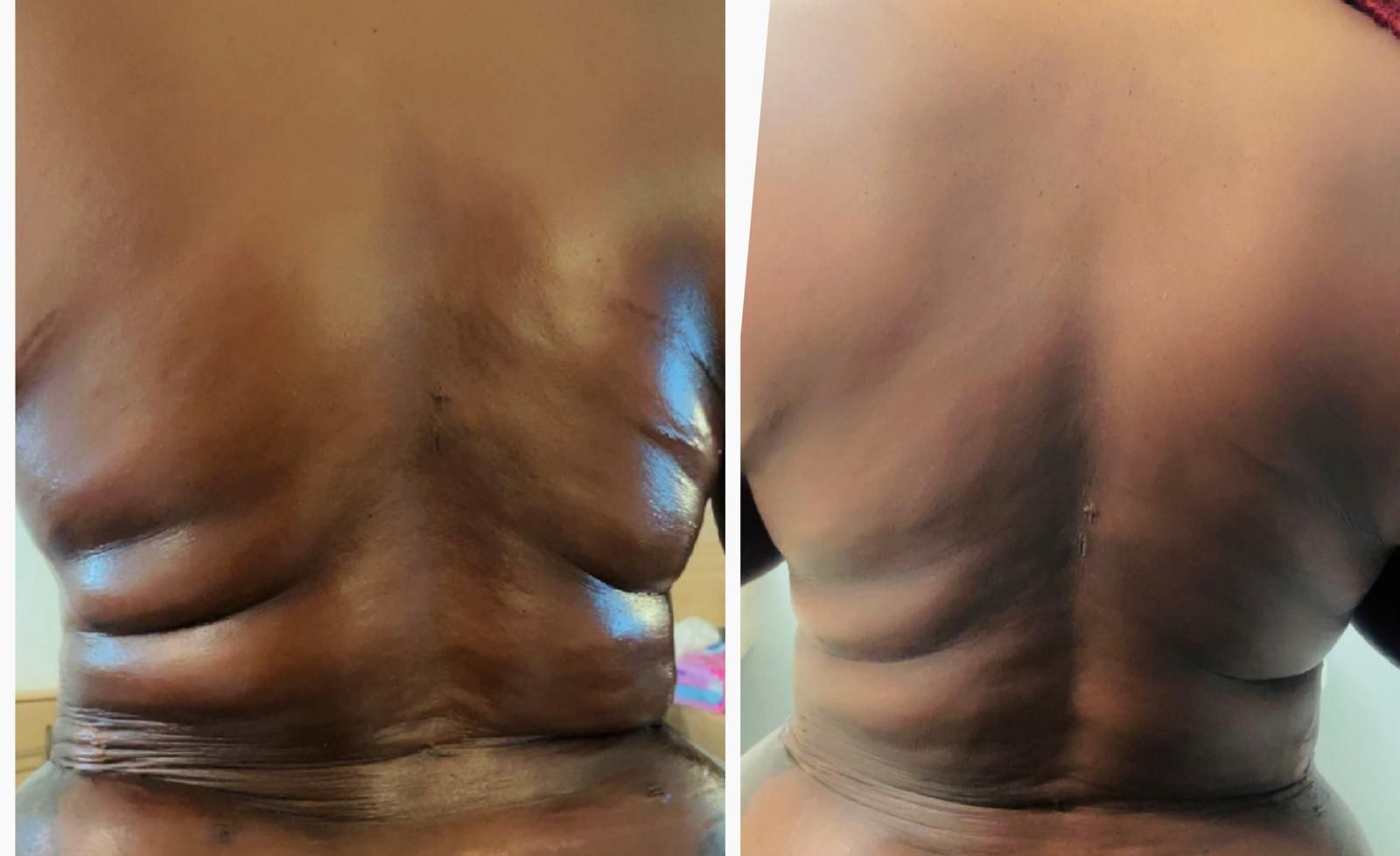 Manual Lymphatic