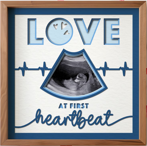 SBox "Love At First Heartbeat" Themed 12" X 12" Shadow Box Frame