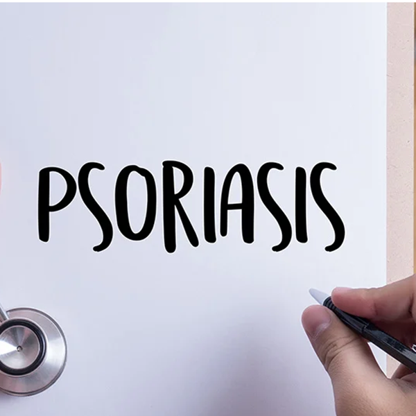 Guía psoriasis