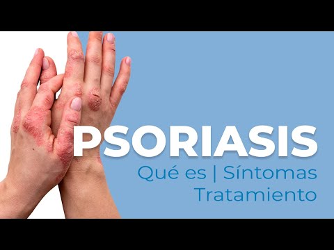 Guía psoriasis