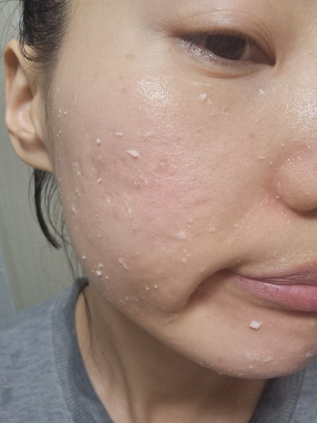 Peeling Gel Face Exfoliator, collagen gentle Peeling Gel, Brightening Facial Exfoliator, All Skin Types