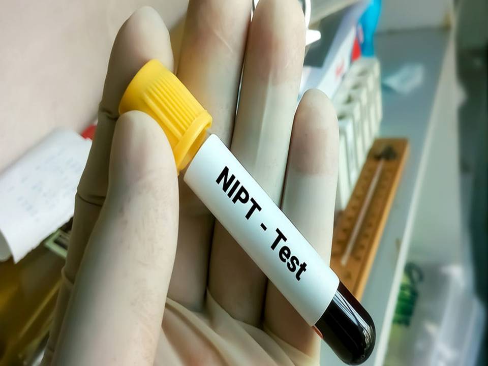 Japan Non-Invasive Prenatal Testing Market Size, Trends, Growth and Forecasts, 2024 – 2032