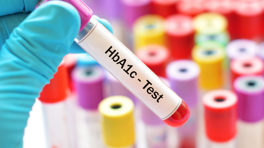 HbA1c Testing Market Size, Share, Growth, Trends and Forecast 2025 – 2033