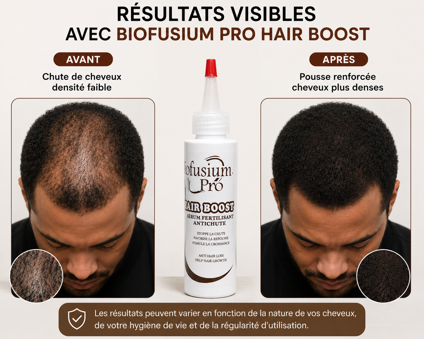Hair Boost Sérum Anti-chute