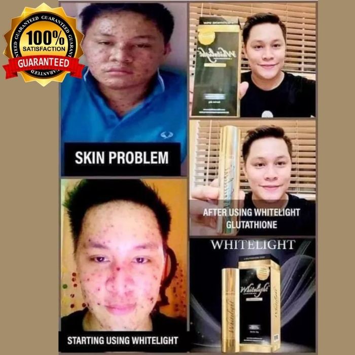 WHITELIGHT L-GLUTATHIONE SPRAY for AIM GLOBAL Skin Lightening 50g