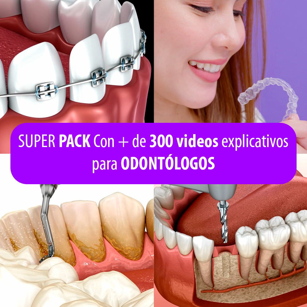 Super Pack +300 Videos Explicativos para Odontólogos