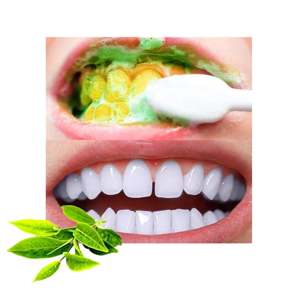 Dentifrice blanchissant