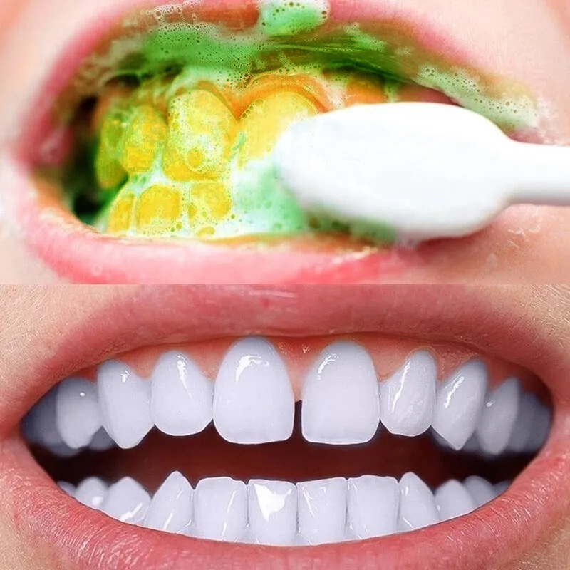 Dentifrice blanchissant