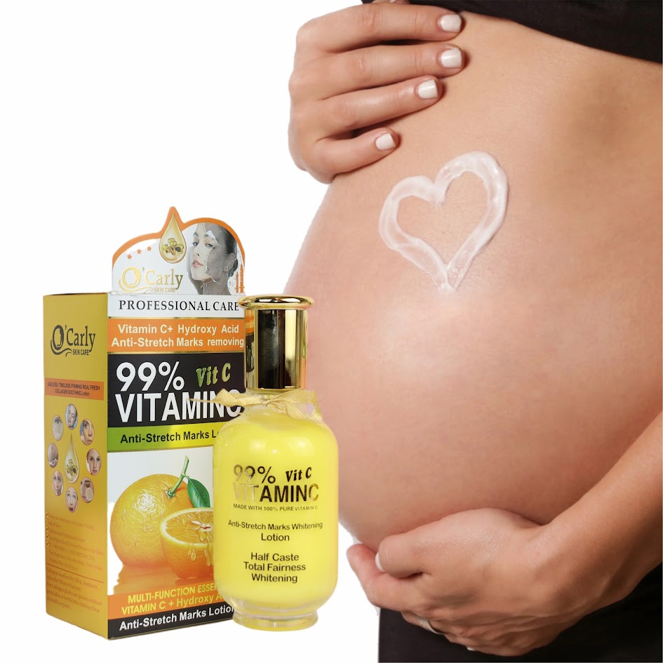 Lotion anti-vergetures à la vitamine C