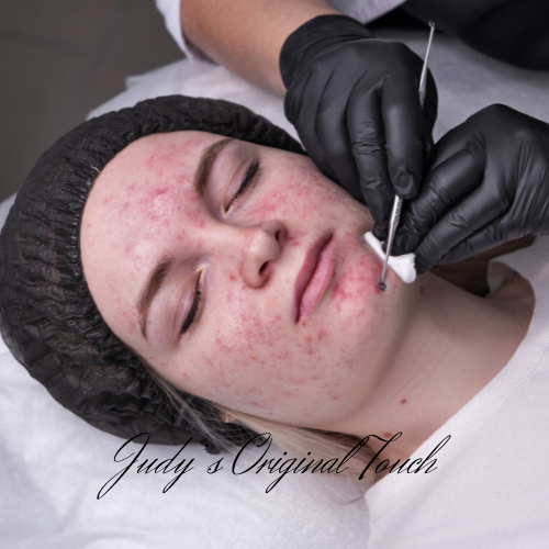 Extraction Deluxe Facial