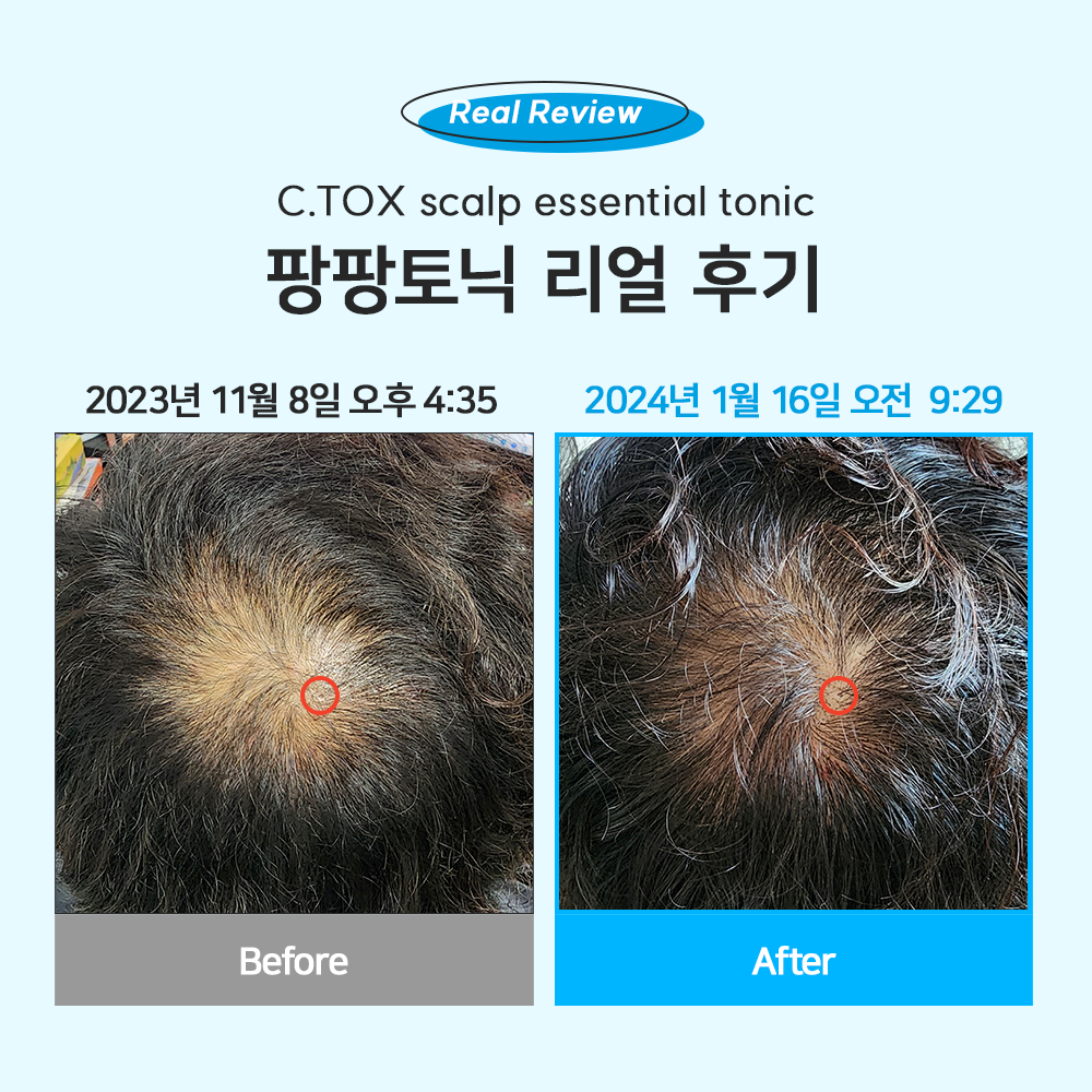 C.TOX Scalp Essential Tonic