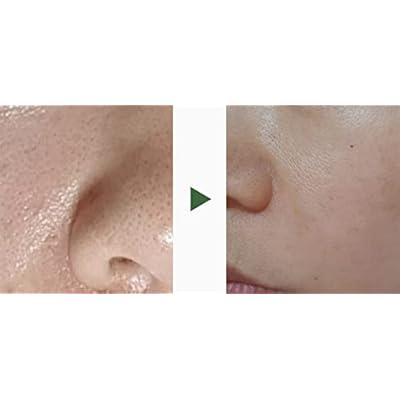 Yeonbisoo The One Treatment Essence
