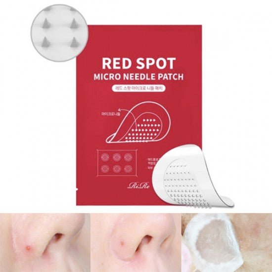 RiRe Red Spot Micro Needle Patch