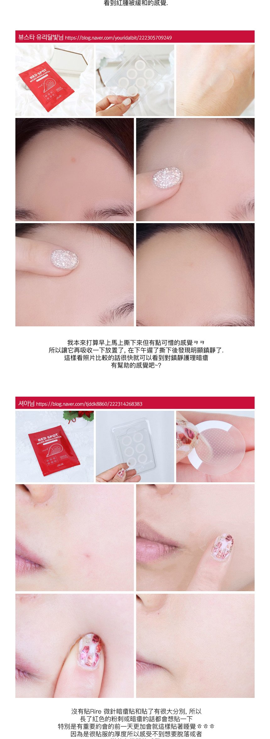 RiRe Red Spot Micro Needle Patch