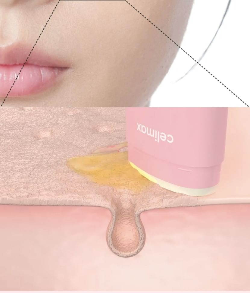 celimax Oil Control Mattifying Sun Stick SPF 50+ / PA++++