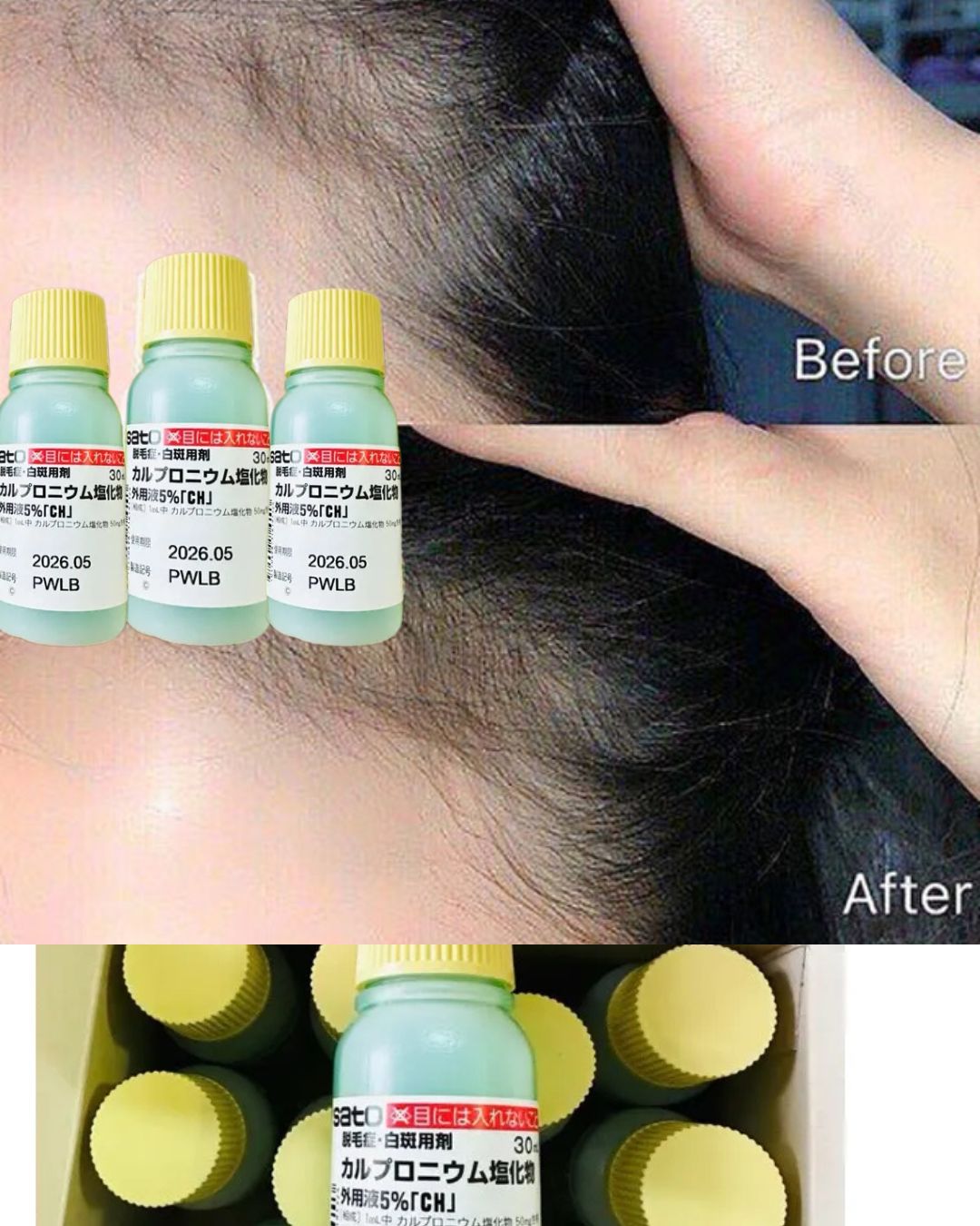 Sato Carpronium Chloride Solution 5% 30ml Hair Fall Tonic Made In Japan 30ml