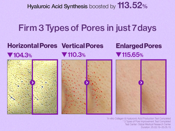 numbuzin No.9 NAD+ PDRN Brightening Toner 150ml